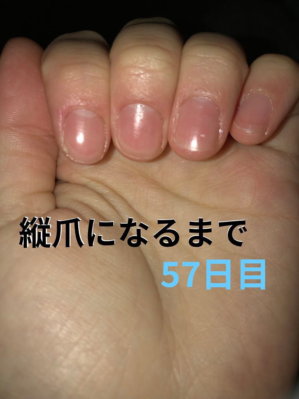 ð on LIPS ã瞊çªã«ãªãããã«ãããããªæ¹æ³ããã£ããæããŠãã ããðã¡ãªã¿..ãïŒ1æç®ïŒ