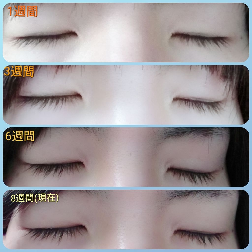 スカルプD ボーテ ピュアフリーアイラッシュセラム/アンファー(スカルプD)/まつげ美容液を使ったクチコミ(4枚目)