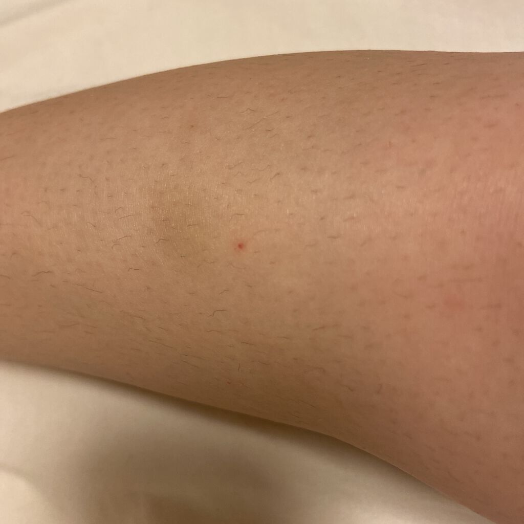 除毛クリーム(敏感肌用)/Veet/除毛クリームを使ったクチコミ（2枚目）