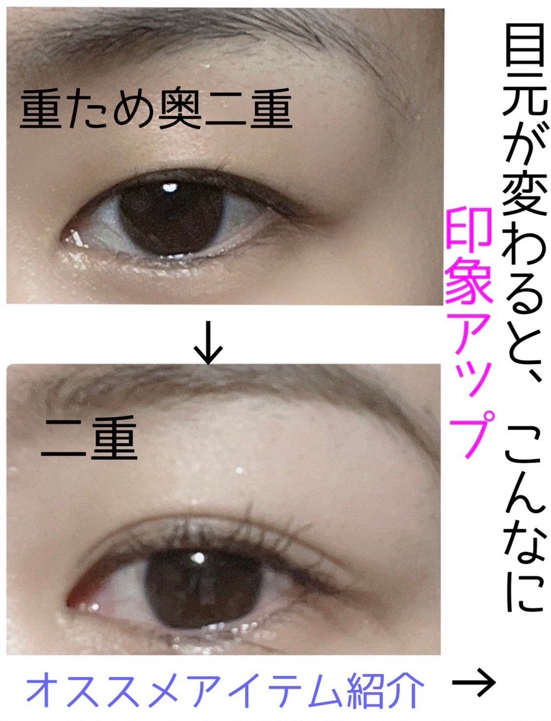 ルドゥーブル プレミアム/ルドゥーブル/二重まぶた用アイテムを使ったクチコミ(1枚目)