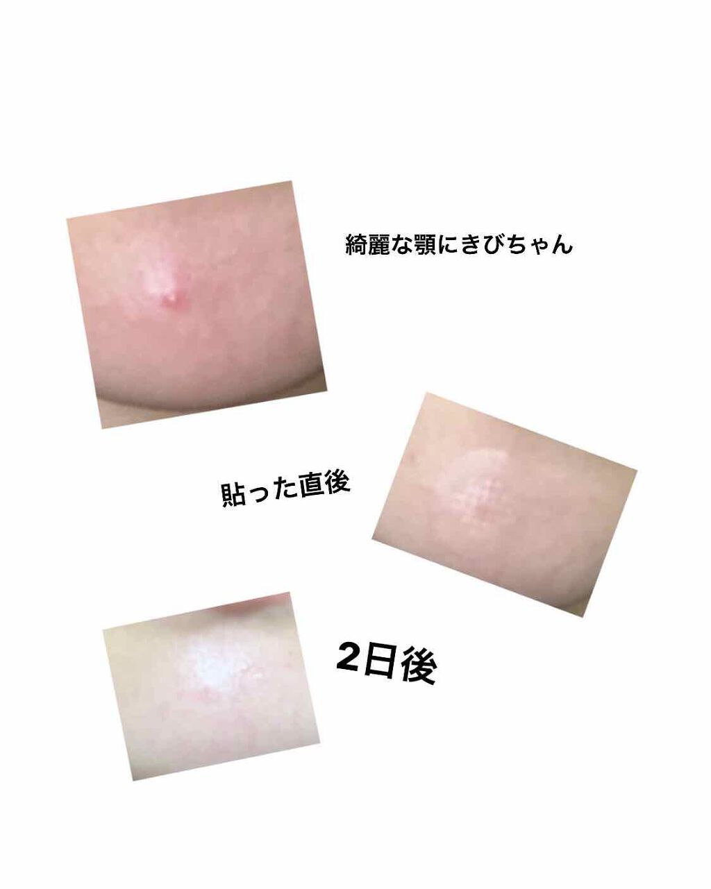 トラブルキュア/美肌ファクトリー/シートマスク・パックを使ったクチコミ(2枚目)