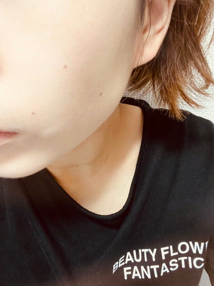 Wエッセンス/shimaboshi/美容液を使ったクチコミ(5枚目)