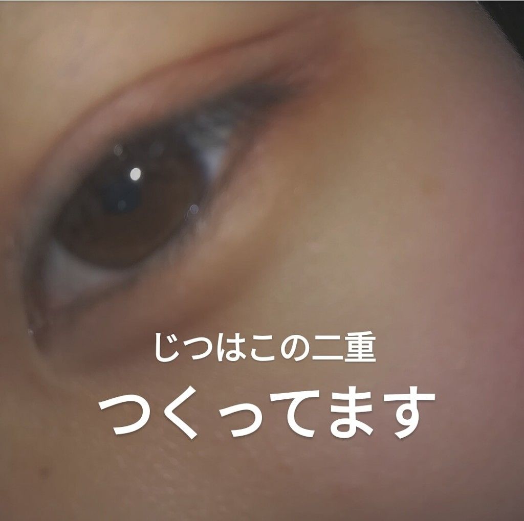 アイトーク/アイトーク/二重まぶた用アイテムを使ったクチコミ（1枚目）