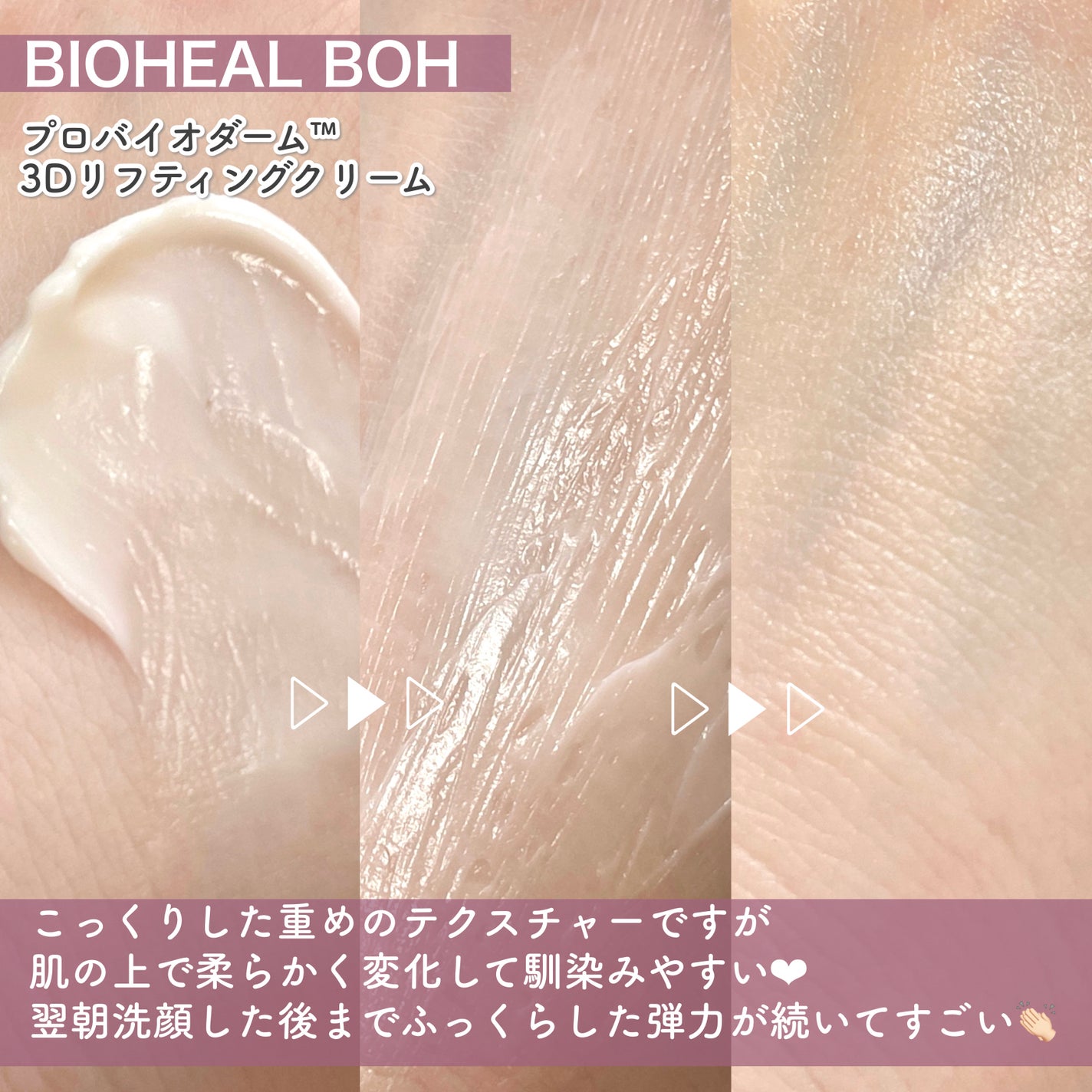 バイオヒールボ プロバイオダーム 3Dリフティングクリーム/BIOHEAL BOH/フェイスクリームを使ったクチコミ(6枚目)