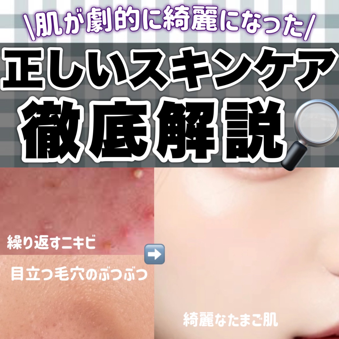 潤いバリア乳液/ももぷり/乳液を使ったクチコミ（1枚目）