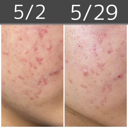 を使ったクチコミ(1枚目)