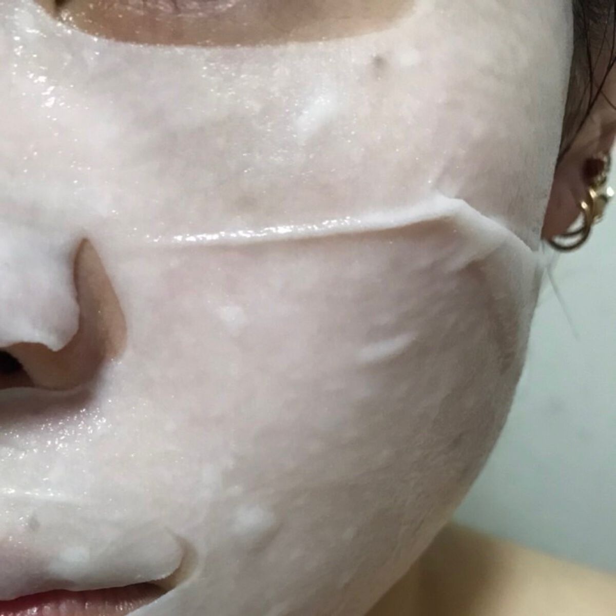 D:NA プロアチンマスク/MEDIHEAL/シートマスク・パックを使ったクチコミ（2枚目）