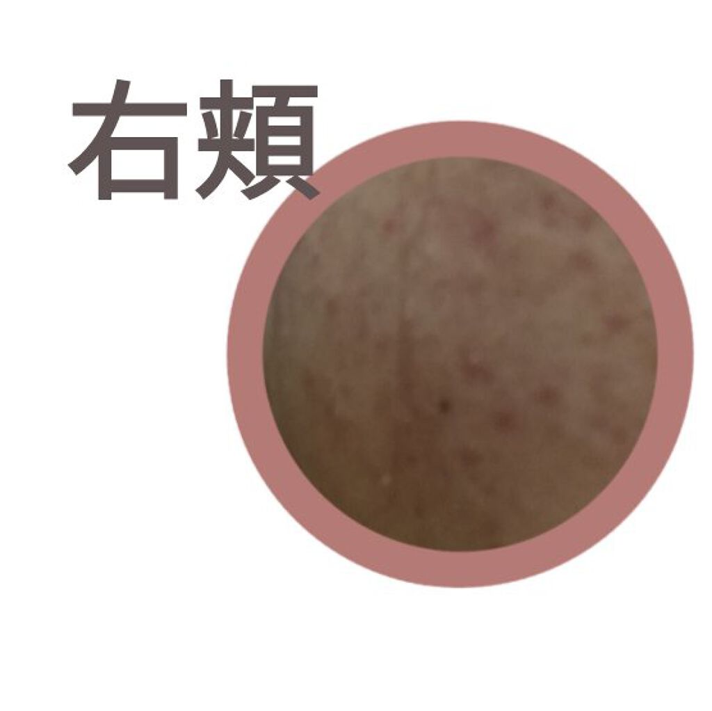 DHC マルチビタミン/DHC/美容サプリメントを使ったクチコミ(2枚目)