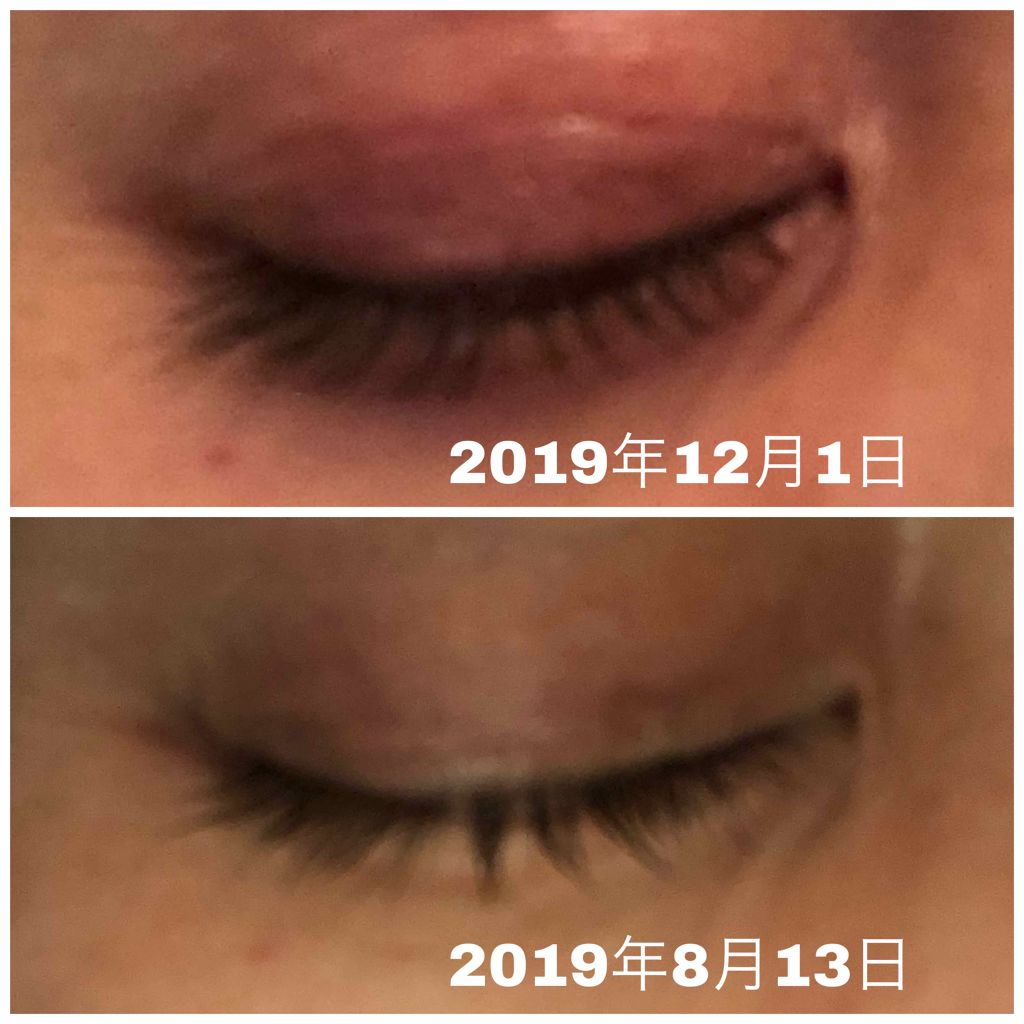 アイシャンプーロング/メディプロダクト/その他洗顔料を使ったクチコミ(3枚目)