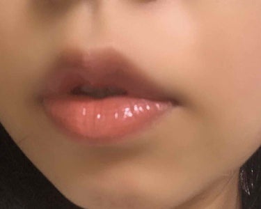 とみぃ on LIPS 「リップ減らしていこうぜキャンペーンは継続中なくせに湘南美容外科..」（3枚目）