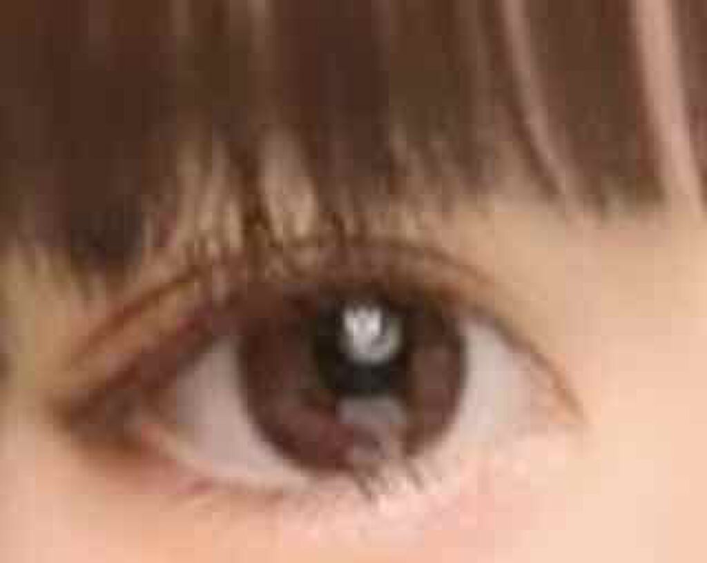 オロナインH軟膏 (医薬品)/オロナイン/その他を使ったクチコミ(3枚目)