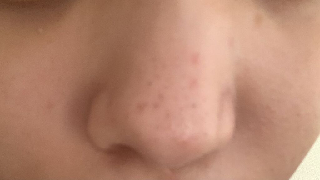 オバジC 酵素洗顔パウダー/オバジ/洗顔パウダーを使ったクチコミ（3枚目）