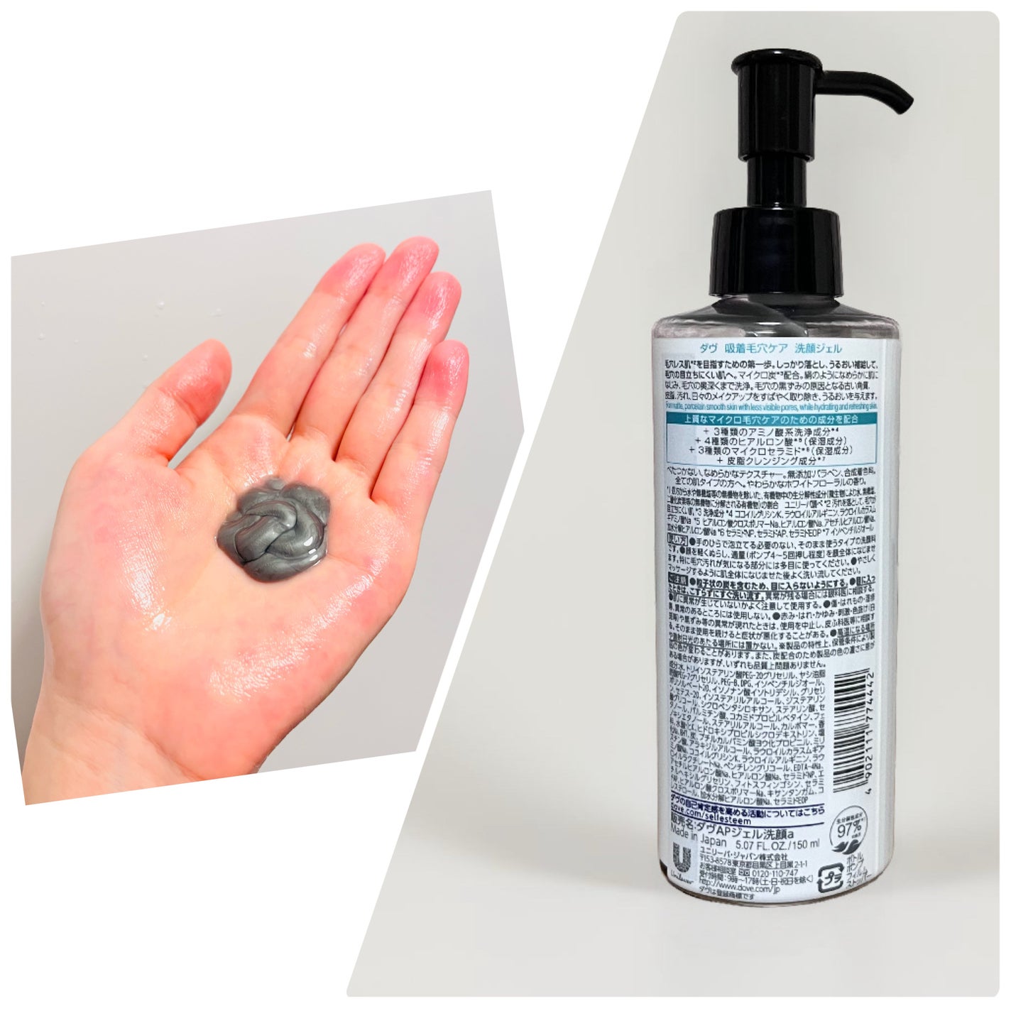 ã㎠åžçæ¯ç©Žã±ã¢ æŽé¡ãžã§ã«/ããŽ/ãã®ä»æŽé¡æã䜿ã£ãã¯ãã³ãïŒ2æç®ïŒ