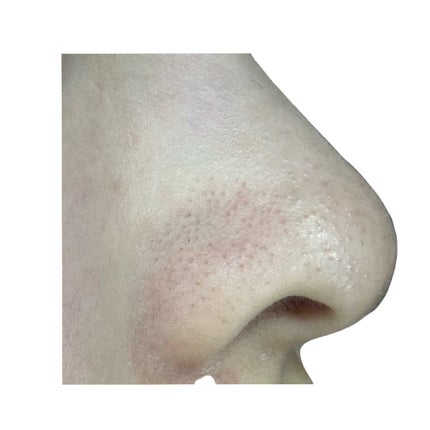 デュオ ザ クレンジングバーム ブラックリペア /DUO/クレンジングバームを使ったクチコミ(3枚目)