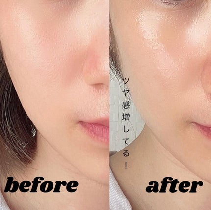 chipi on LIPS 「..塗るコラーゲン!?NOWOTER様の商品を試させて頂きまし..」(4枚目)