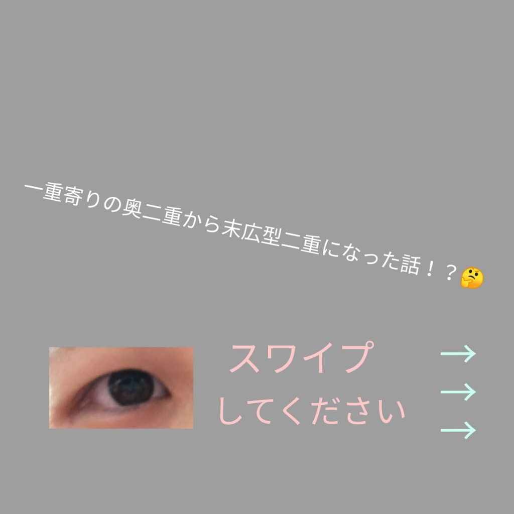 のびーるアイテープ（絆創膏タイプ、レギュラー）/DAISO/二重まぶた用アイテムを使ったクチコミ（1枚目）