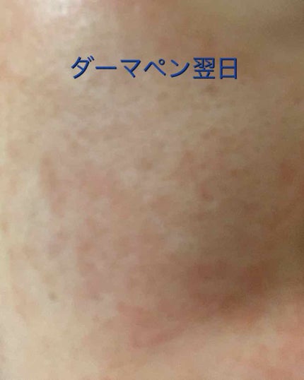 を使ったクチコミ(2枚目)