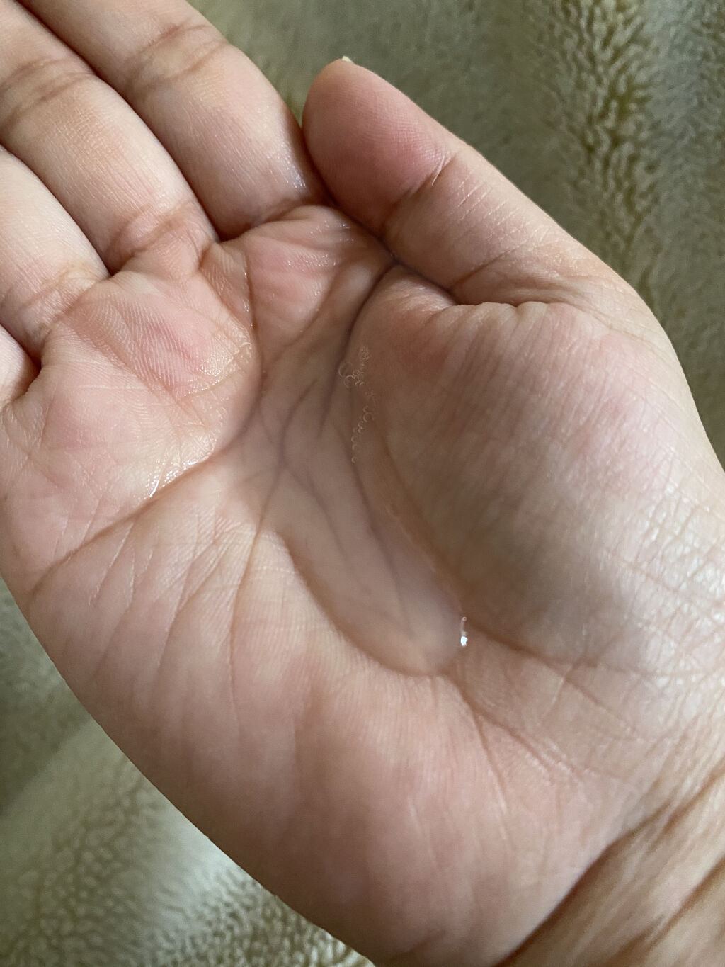 ハトムギ化粧水/ワイズコーポレーション/化粧水を使ったクチコミ（2枚目）