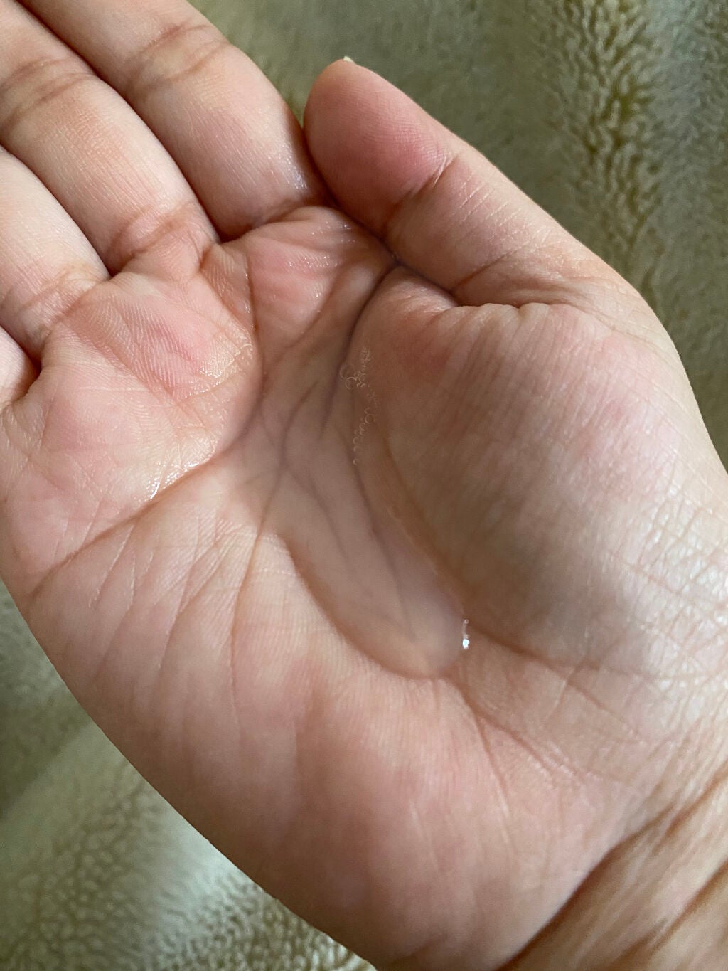 ハトムギ化粧水/ワイズコーポレーション/化粧水を使ったクチコミ(2枚目)