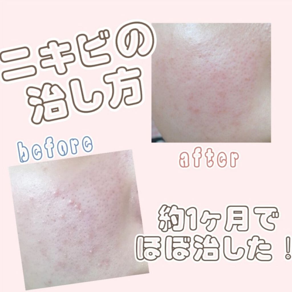 薬用泡のふんわり洗顔/スキンライフ/泡洗顔を使ったクチコミ（1枚目）