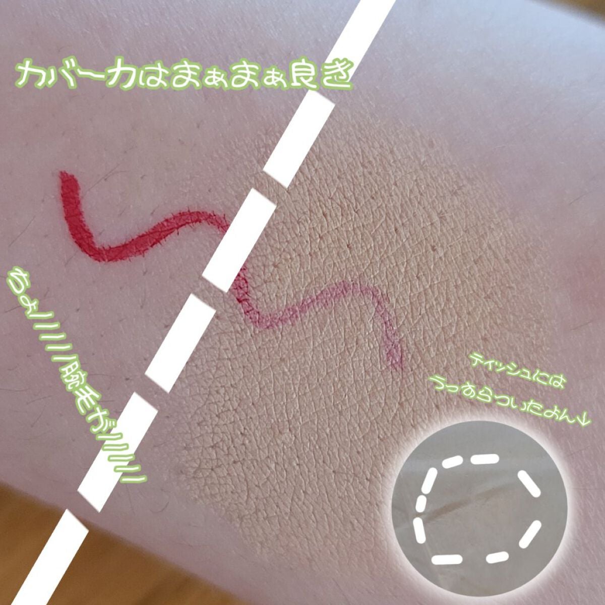 ダーマシンコンシーラー/23years old/リキッドコンシーラーを使ったクチコミ(7枚目)