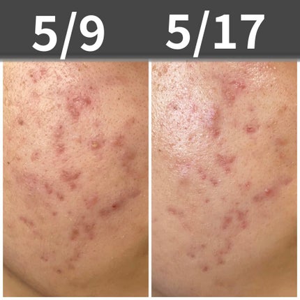 を使ったクチコミ(1枚目)