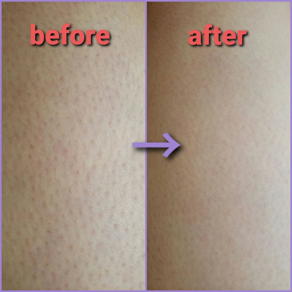 スムーズスキン/DAISO/ムダ毛ケアを使ったクチコミ(2枚目)