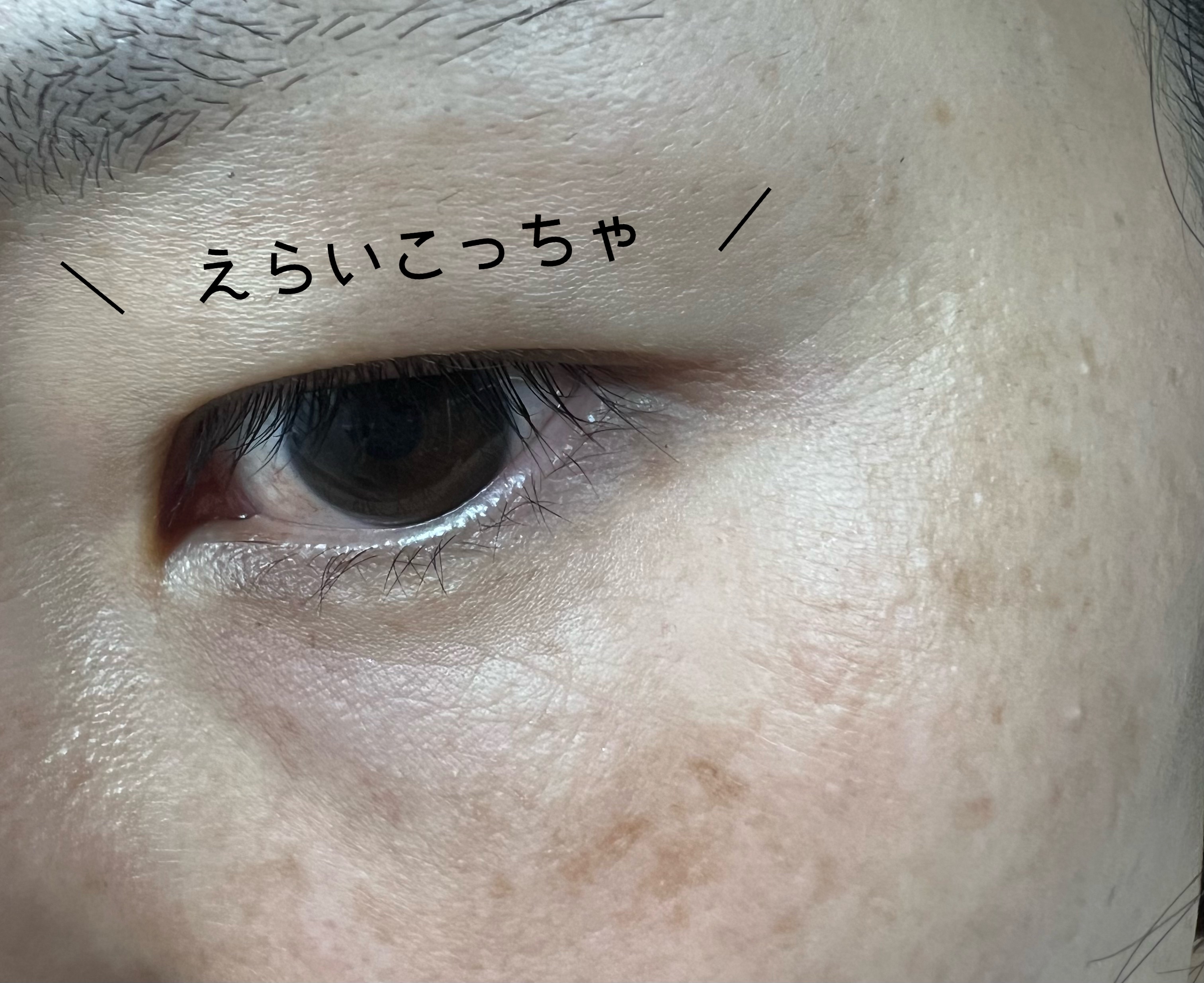 ザ セラム リンクルリペア 朝用 /アスタリフト/美容液を使ったクチコミ（2枚目）