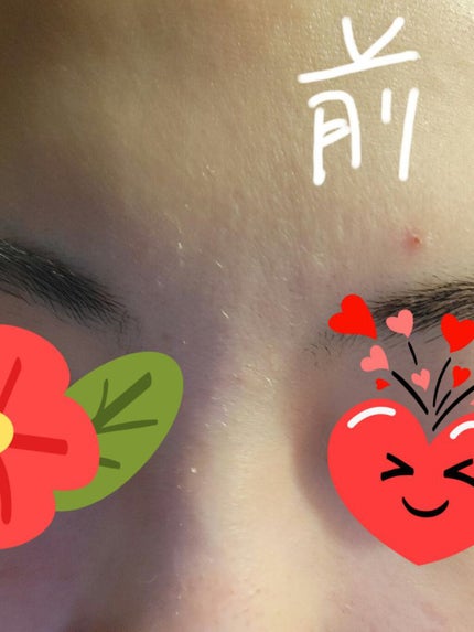 ごめんね素肌マスク/クリアターン/シートマスク・パックを使ったクチコミ(4枚目)