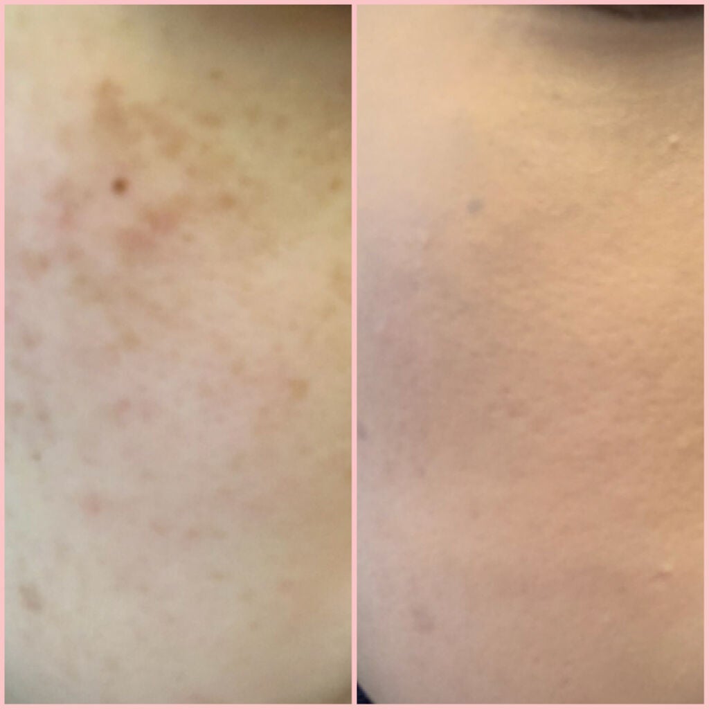 フローレス フィット/COVERMARK/クリーム・エマルジョンファンデーションを使ったクチコミ(3枚目)