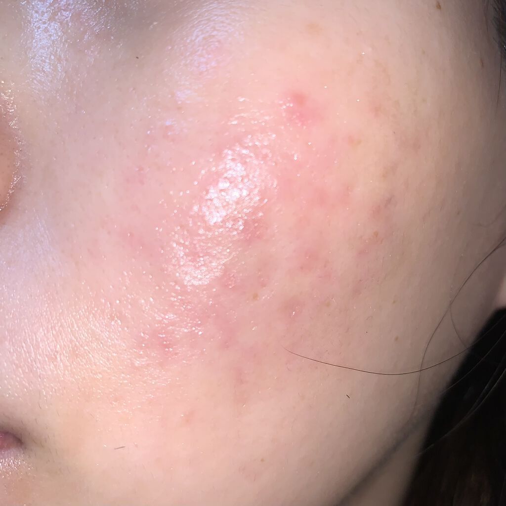 Easydew EX REPAIR CONTROL EGF/Easydew/フェイスクリームを使ったクチコミ（1枚目）