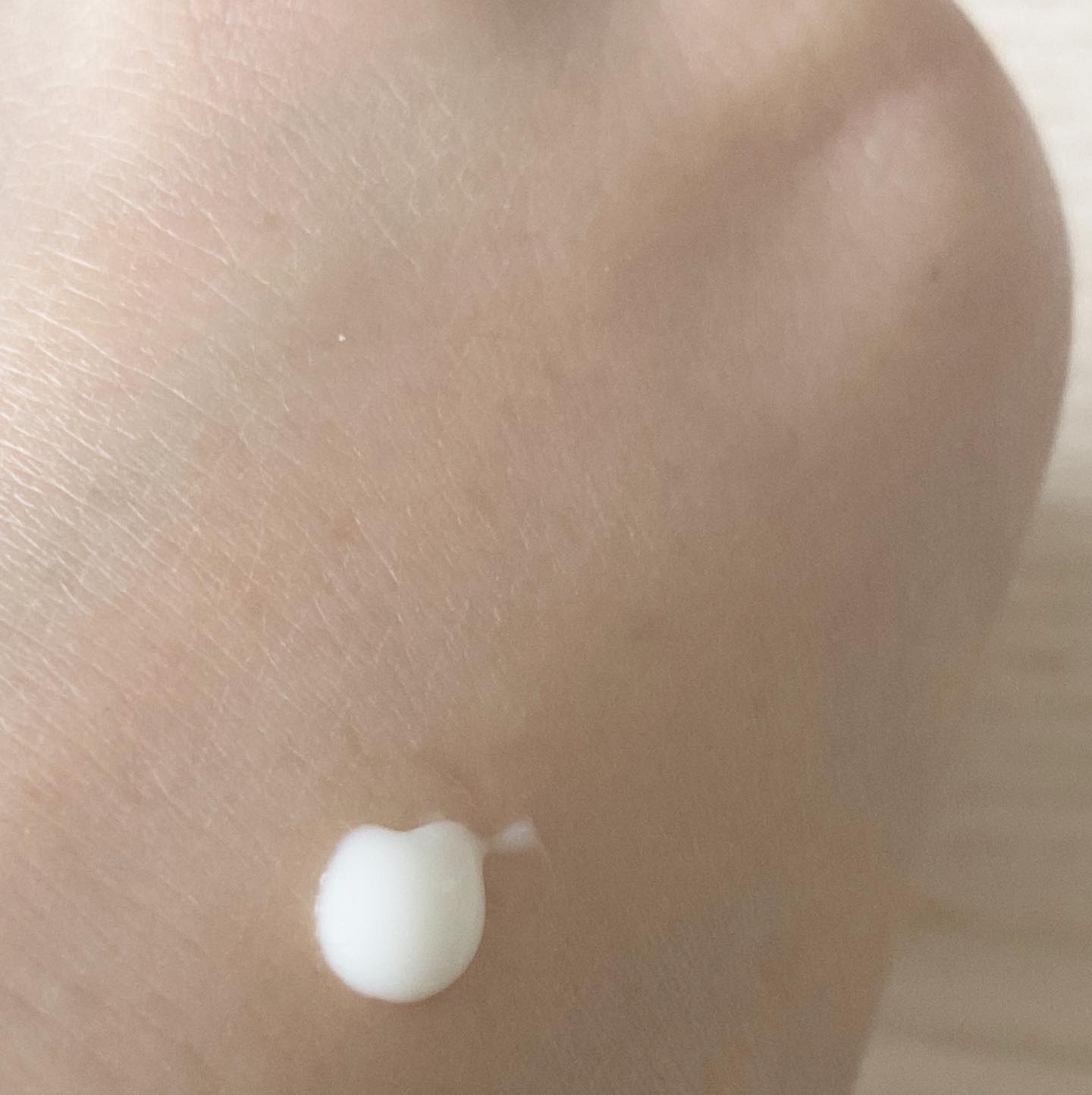 シカレチA エッセンス0.1/VT/美容液を使ったクチコミ（2枚目）