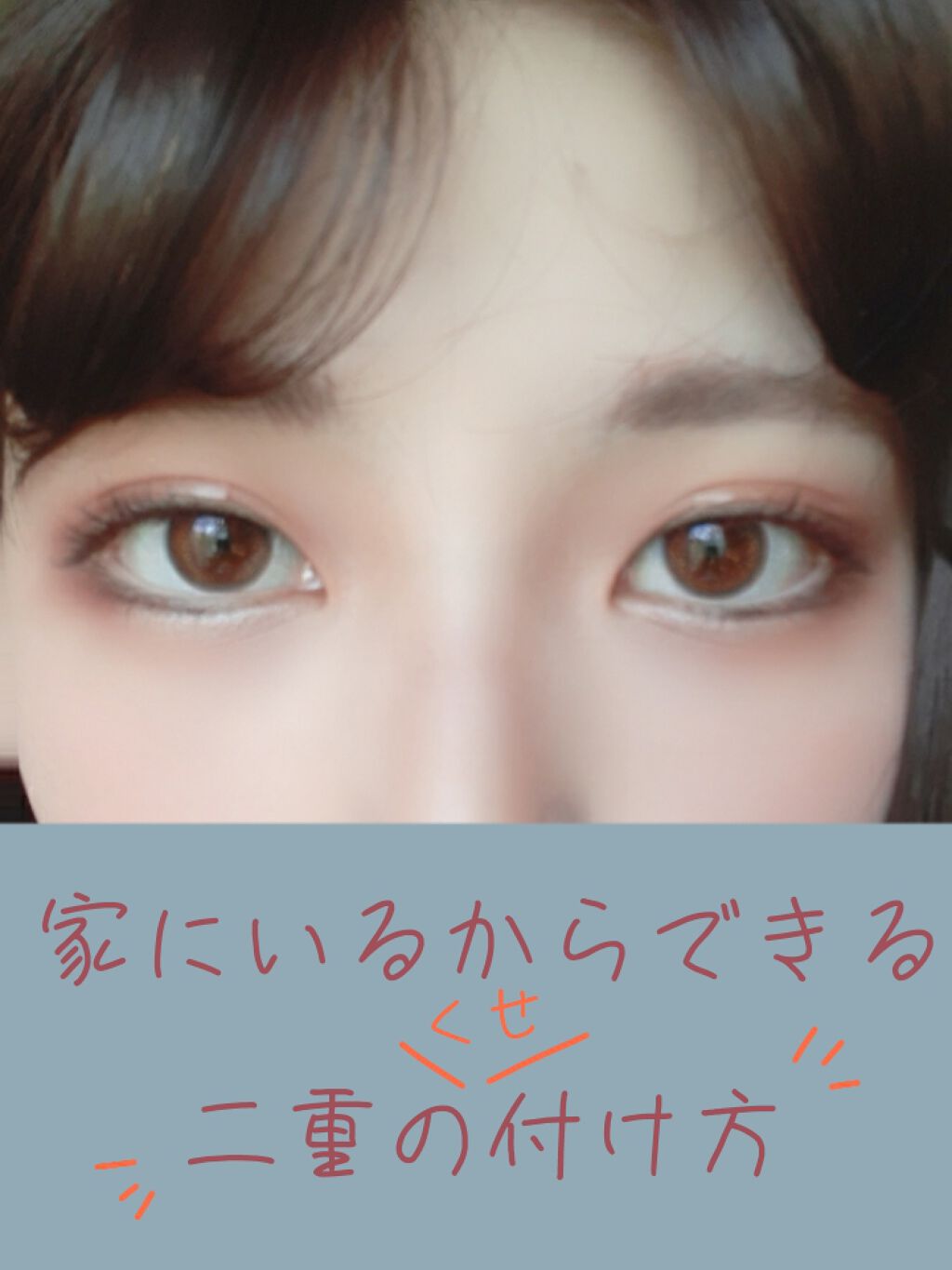 絆創膏/その他を使ったクチコミ（1枚目）