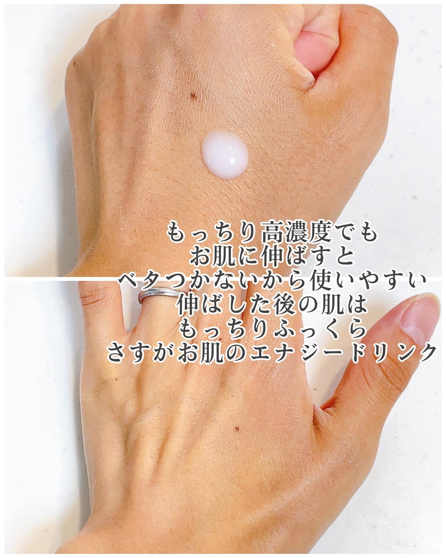 プロバイオシカ インテンシブ アンプル/SKIN1004/美容液を使ったクチコミ(4枚目)