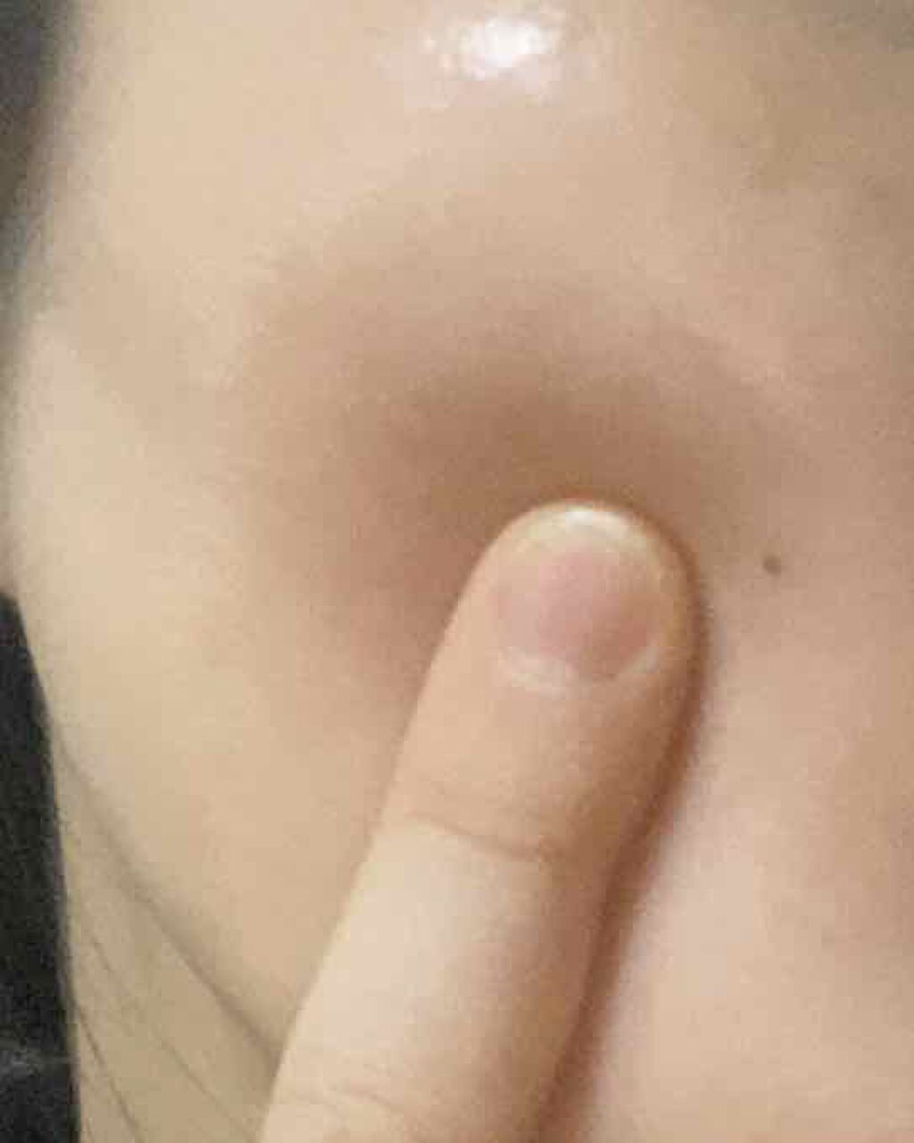 DMT インテンシブフェイシャルクリーム/PHYSIOGEL/フェイスクリームを使ったクチコミ(4枚目)