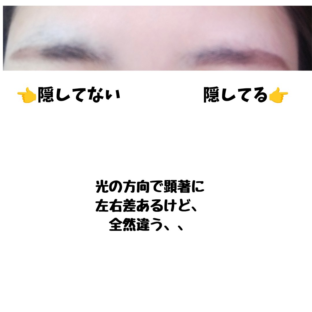 カラーミキシングコンシーラー 12 イエロー＆オレンジベージュ/キャンメイク/パレットコンシーラーを使ったクチコミ（2枚目）