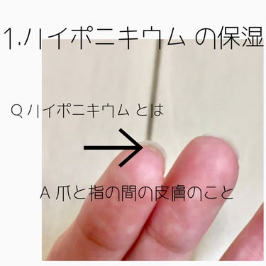 アンドネイル ネイルベッドオイルのクチコミ「約２ヶ月でハイポニキウム を育成
美爪になろう🖐

アンドネイル ネイルベッドオイル
¥1,7.....」（2枚目）