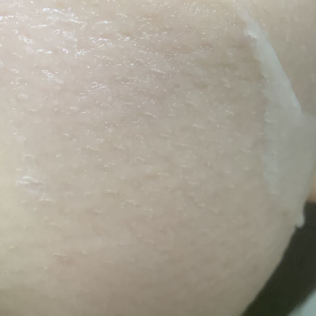 シカルファットプラス リペアクリーム/アベンヌ/フェイスクリームを使ったクチコミ（3枚目）