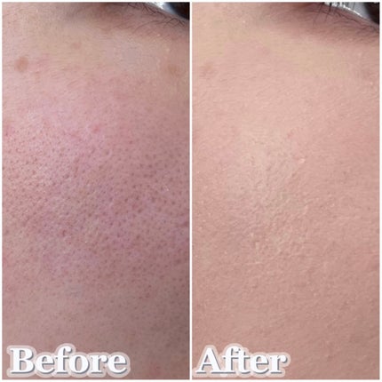 プロテーラービーベルベットカバークッション/espoir/クッションファンデーションを使ったクチコミ(3枚目)