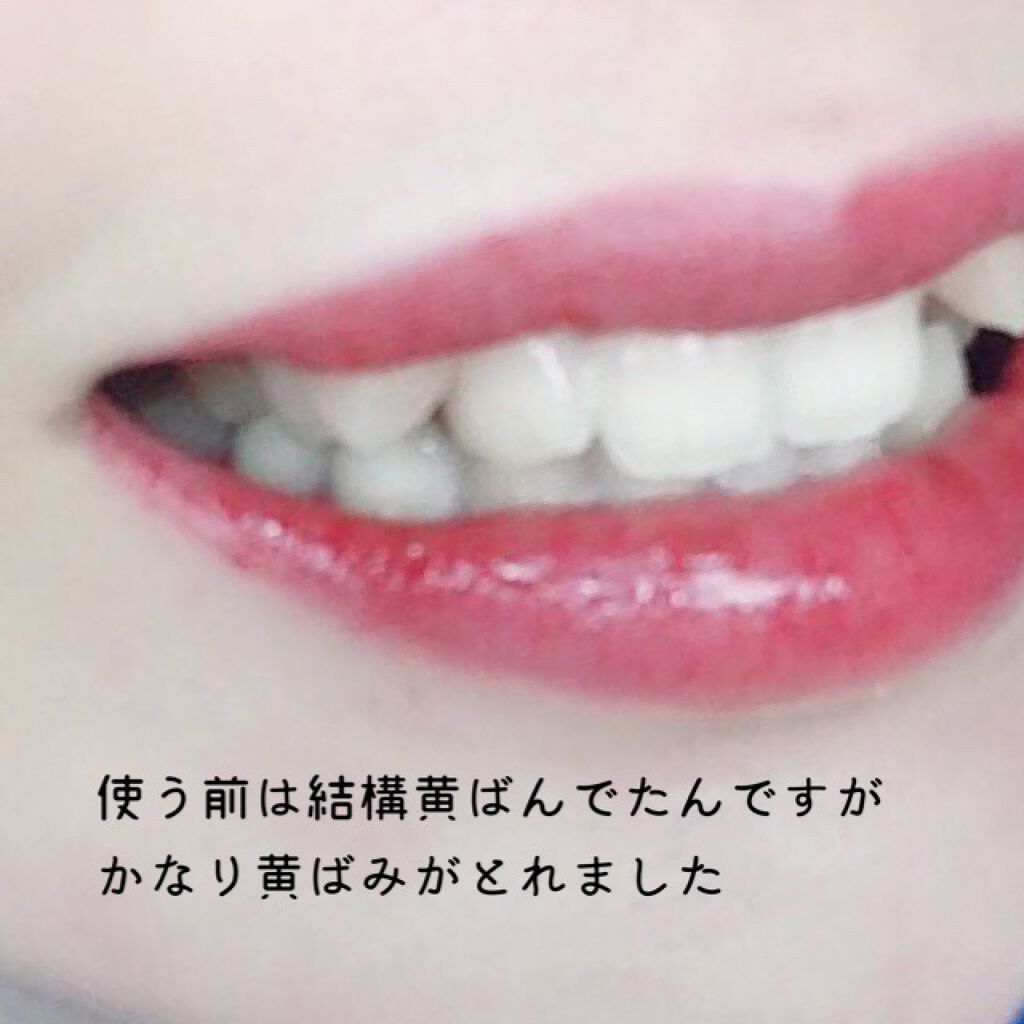 ホワイトニングパウダー ミント/Dr.Oral/歯磨き粉を使ったクチコミ(5枚目)