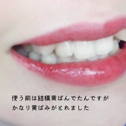 ホワイトニングパウダー ミント/Dr.Oral/歯磨き粉を使ったクチコミ(5枚目)