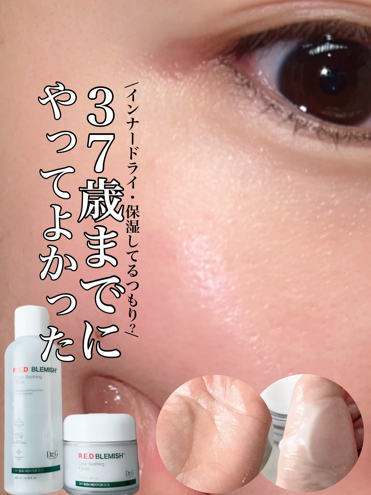 レッドブレミッシュ クリアスージングトナー/Dr.G/化粧水を使ったクチコミ（1枚目）