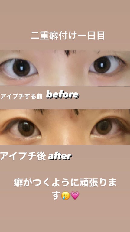 のび〜る アイテープ 両面テープタイプ/DAISO/二重まぶた用アイテムを使ったクチコミ(2枚目)