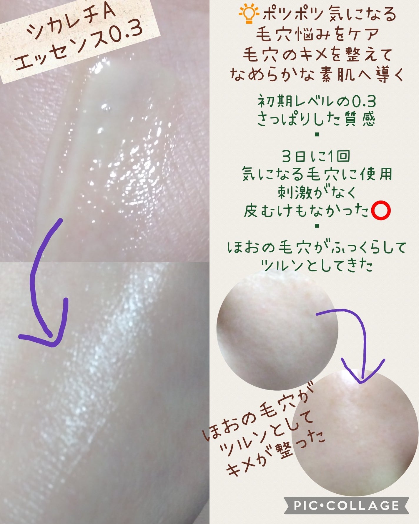 シカレチA エッセンス0.3/VT/美容液を使ったクチコミ(3枚目)