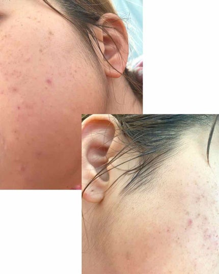 スポッツカバー ファウンデイション/SHISEIDO/クリームコンシーラーを使ったクチコミ(1枚目)