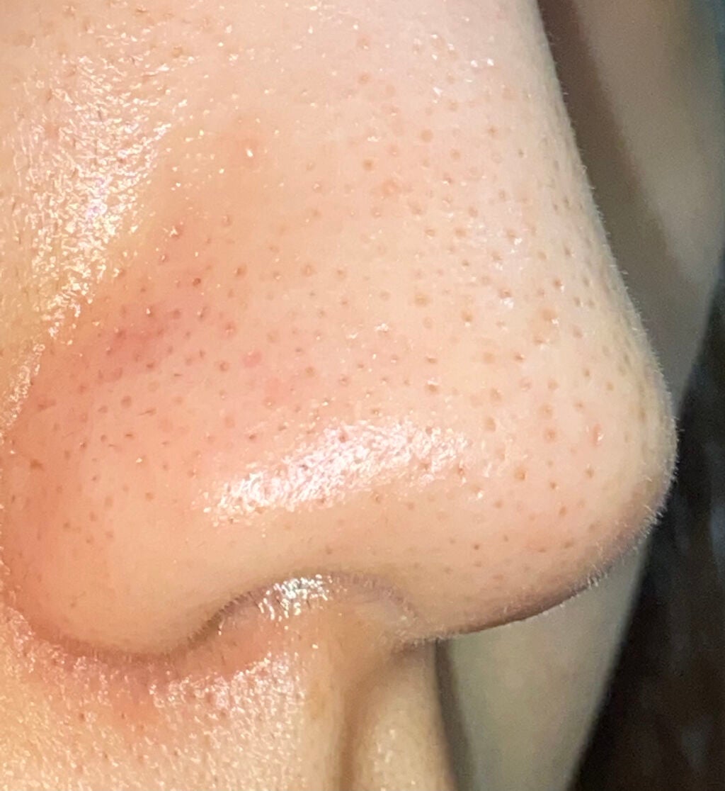 クラゲチャン on LIPS 「結構変わった長かったなぁ..」(3枚目)