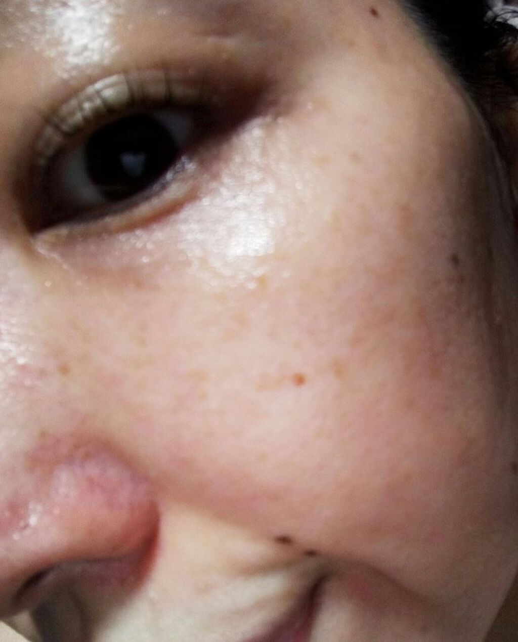 ハニーラボ 発酵蜜エッセンス/アピセラピーコスメティクス/美容液を使ったクチコミ(4枚目)