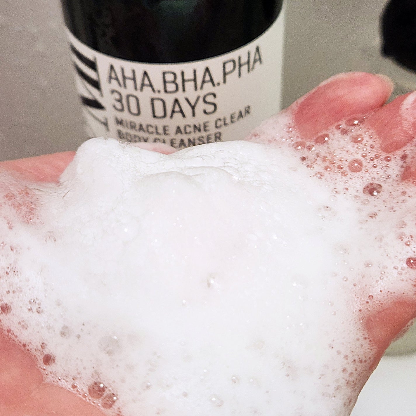 AHA·BHA·PHA 30デイズミラクルアクネボディクレンザー/SOME BY MI/ボディソープを使ったクチコミ(2枚目)