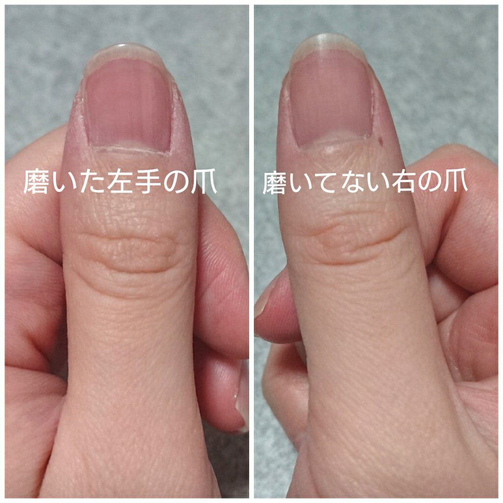 爪ピカッシュ/小林製薬/ネイル用品を使ったクチコミ（3枚目）