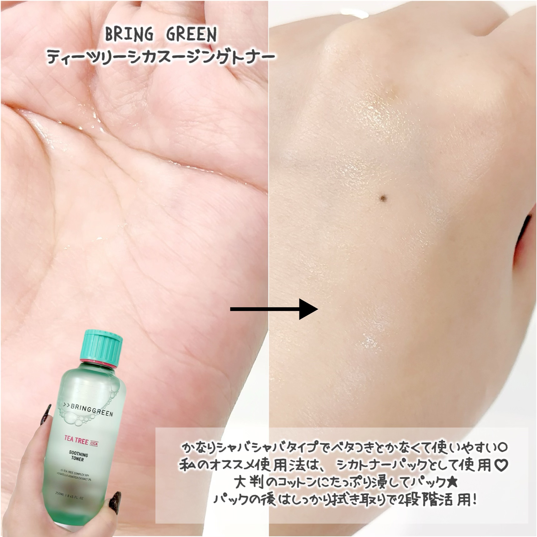 ティーツリーシカスージングトナー/BRING GREEN/化粧水を使ったクチコミ（3枚目）